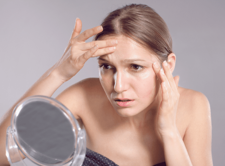 Como Disimular La Frente Grande 20 Mejores Trucos Esmilna Castillo